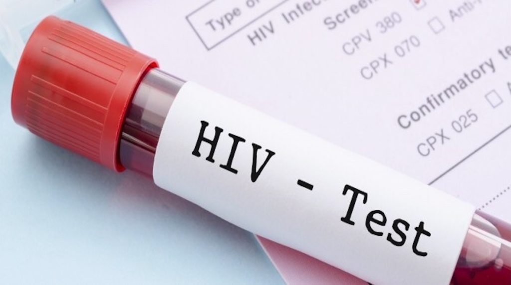 HIV - Test Tube